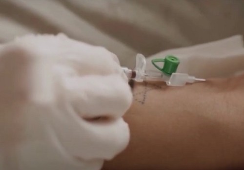 Lời Cảnh Báo: Nguy hiểm từ “trào lưu” lọc máu ngừa đột quỵ